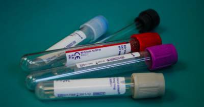 В Украине не будут проводить тест на антитела перед вакцинацией от COVID-19
