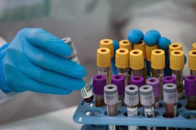 Почти 300 новых случаев коронавируса выявлено в СКФО за сутки
