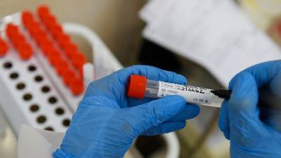 В Москве за сутки выявили 1728 случаев коронавируса