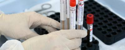 В Волгоградской области выявлен еще 131 заразившийся коронавирусом