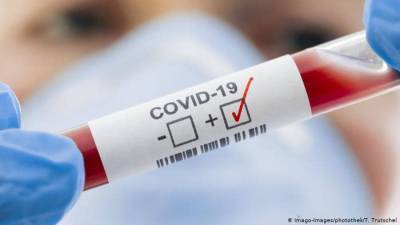 В Луганской области лабораторно подтверждено 23 новых случая COVID-19