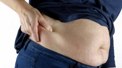 Эндокринолог перечислила главные причины ожирения