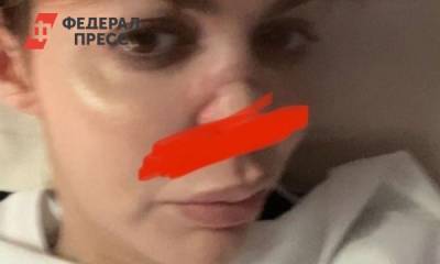 «Уберите детей от экранов»: что стало с бывшей женой Аршавина из-за болезни
