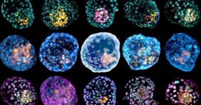 Жизнь из пробирки. В лаборатории созданы первые полные модели эмбриона человека