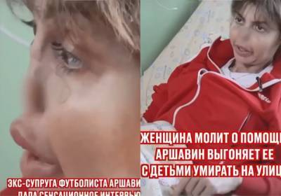 Жена Аршавина лишилась носа из-за аутоимунного некроза и боится повторения судьбы Началовой