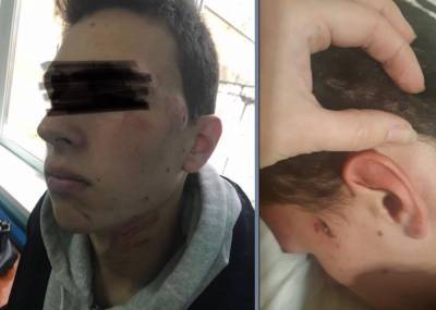 Житель Екатеринбурга третий год пытается наказать бизнесмена, избившего его сына
