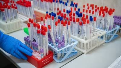 В России планируют запустить производство тестов для определения мутации коронавируса