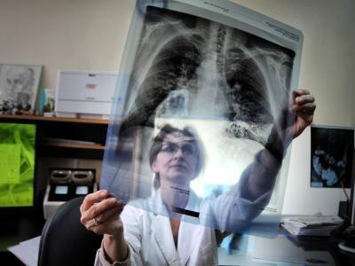 «У вас туберкулез»: южноуральцы рассказали, как победили коварную болезнь