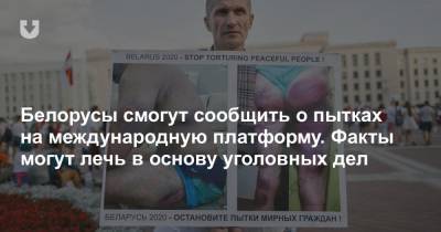 Белорусы смогут сообщить о пытках на международную платформу. Факты могут лечь в основу уголовных дел