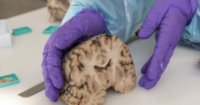 Ученые обнаружили "зомби гены", увеличивающие активность в мозге после смерти