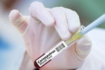 40 новых случаев заболевания COVID выявили в Татарстане