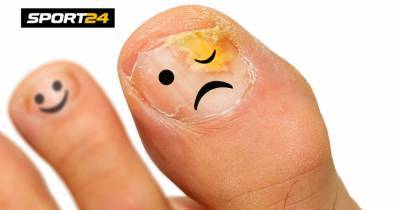 Грибок ногтей опасен для здоровья. Как и чем его лечить