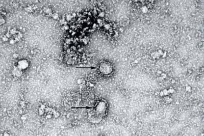 Американский ученый выдвинул версию происхождения нового коронавируса