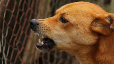 Бродячая собака искусала лицо двухлетнего мальчика в Красноярске
