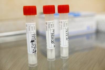 В России зарегистрирован первый ПЦР-тест на малярию - vm.ru