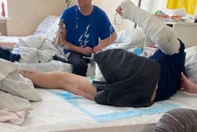 Фронтовой волонтер опубликовала фото тяжелораненых бойцов ВСУ. Фото +18