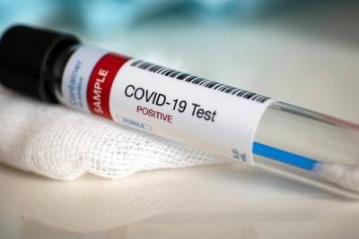 Ученые выяснили, каким образом может выделяться коронавирус