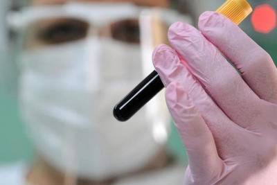 Коронавирусом в Тамбовской области заболели 50 мужчин