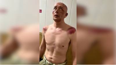 Пензенский адвокат пожаловался на пытки его подзащитного в полиции