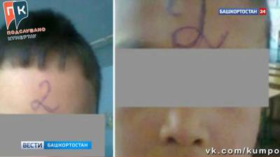 Первокласснице башкирской школы учитель поставила "двойку" на лоб
