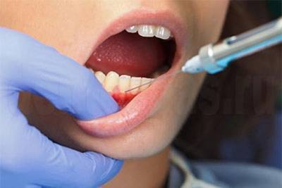 Пятилетняя девочка умерла в Туве после укола у стоматолога