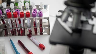 Российский врач озвучил метод проверки крови после COVID-19