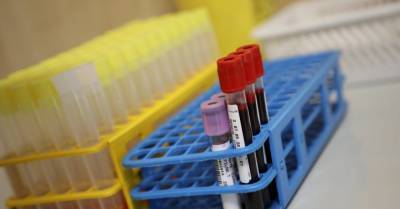 За минувшие сутки в Литве подтверждено 434 новых случая коронавируса