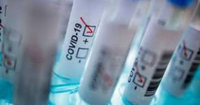 На Луганщине лабораторно подтверждено 50 новых случаев COVID-19