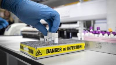 Швейцария бесплатно протестирует на коронавирус все население