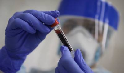 В двух краях Латвии проведут массовое тестирование на коронавирус
