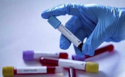 Коронавирусом в Украине заразилось более 5,5 тысячи человек за сутки