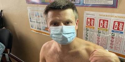 Депутат Верховной Рады Алексей Гончаренко сделал укол вакцины от COVID-19, фото - ТЕЛЕГРАФ