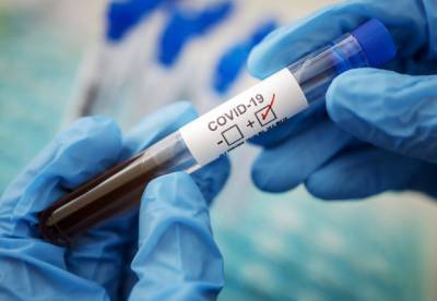 В Украине 17 569 новых случаев коронавируса
