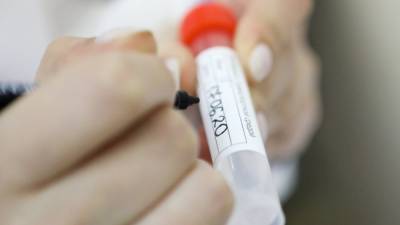 Медики выявили 9169 новых случаев заболевания коронавирусом за сутки в России