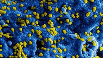В России выявили почти 80 случаев заражения «британским» штаммом коронавируса
