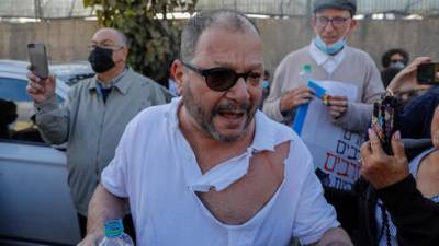 Избиение депутата кнессета в Иерусалиме: что говорит полиция