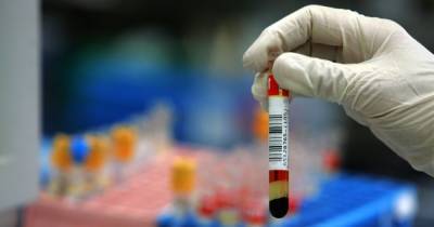 Коронавирус в Украине: количество инфицированных упало на треть, количество тестов — вдвое