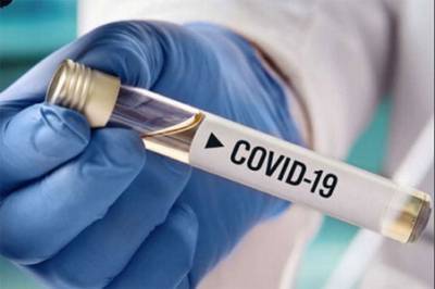 На Луганщине лабораторно подтверждено 72 новых случая COVID-19