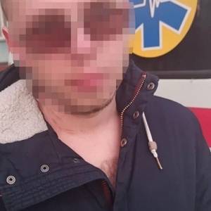 В Запорожье задержали 26-летнего парня, который «заминировал» жилой дом ради развлечения. Фото