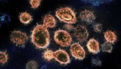 В Украину могут завезти «калифорнийский» коронавирус