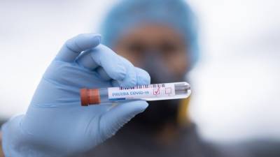 Медики зафиксировали 8173 новых случая заболевания коронавирусом за сутки в России