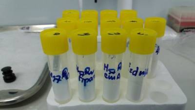 Израильские ученые создадут лекарство от COVID-19 на основе молочных продуктов