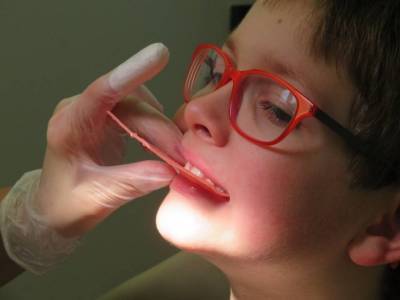 Детская ортодонтия – как сегодня исправляют дефекты прикуса: рассказывает эксперт «ПрезиДЕНТ Престиж»