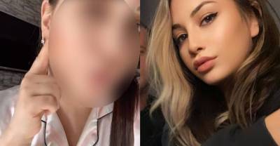 Блогерша показала, какими жуткими прыщами покрылось её лицо из-за косметики от Оксаны Самойловой