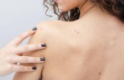 Как распознать рак кожи всего по трем признакам