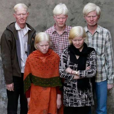 В Индии обнаружили самую большую в мире семью альбиносов (ФОТО)