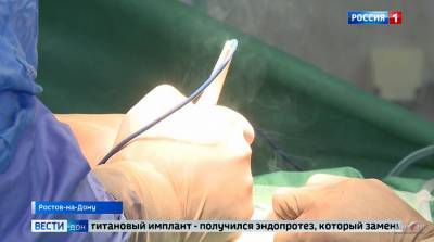 Ростовские врачи провели операцию по замене позвонков эндопротезом из ребра пациентки