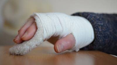 Жительница Мурманской области сломала руку во время пылких занятий любовью