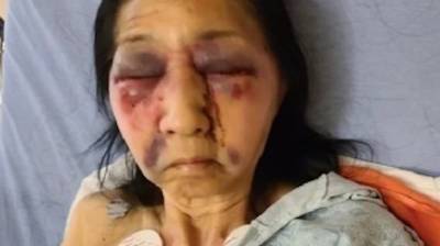70-летнюю женщину избили в автобусе, приняв за азиатку