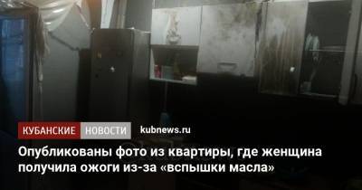 Опубликованы фото из квартиры, где женщина получила ожоги из-за «вспышки масла»